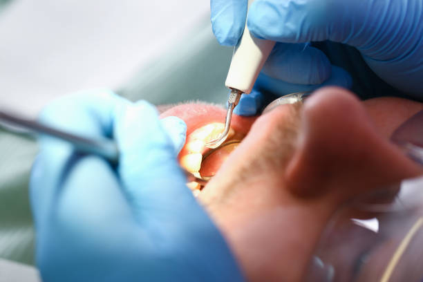 Best Emergency Treatment for Dental Infections or Abscesses in Monticello, UT